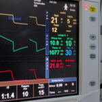 Detailaufnahme eines medizinischen Monitors eines Beatmungsgeräts mit verschiedenen Kurvendiagrammen und Vitalparametern wie Druck, Flow und CO2-Werten.