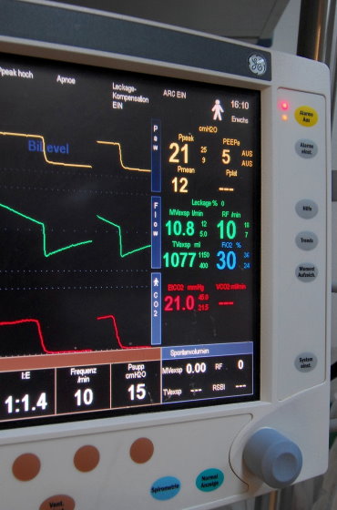 Detailaufnahme eines medizinischen Monitors eines Beatmungsgeräts mit verschiedenen Kurvendiagrammen und Vitalparametern wie Druck, Flow und CO2-Werten.
