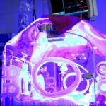 Ein medizinischer Inkubator für Frühgeborene im Einsatz. Der Innenraum wird durch eine Fototherapie-Lampe intensiv violett-blau beleuchtet. Im Hintergrund ist ein Monitor zur Überwachung der Vitalwerte erkennbar.